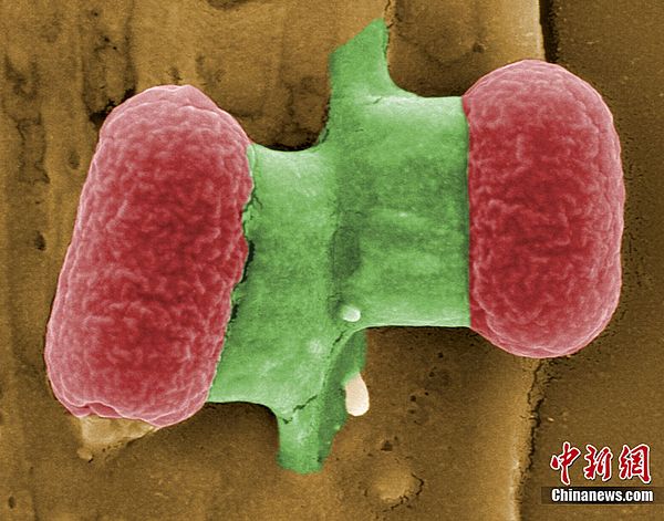 华人细菌专家:德国肠道疾病感染源仍有许多未解之谜