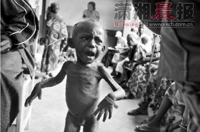 2009年7月底,一个因营养不良而骨瘦如柴的非洲儿童.