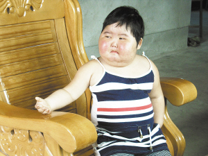 龙岩5岁女童一个月暴胖30斤 体内肿瘤像铅球